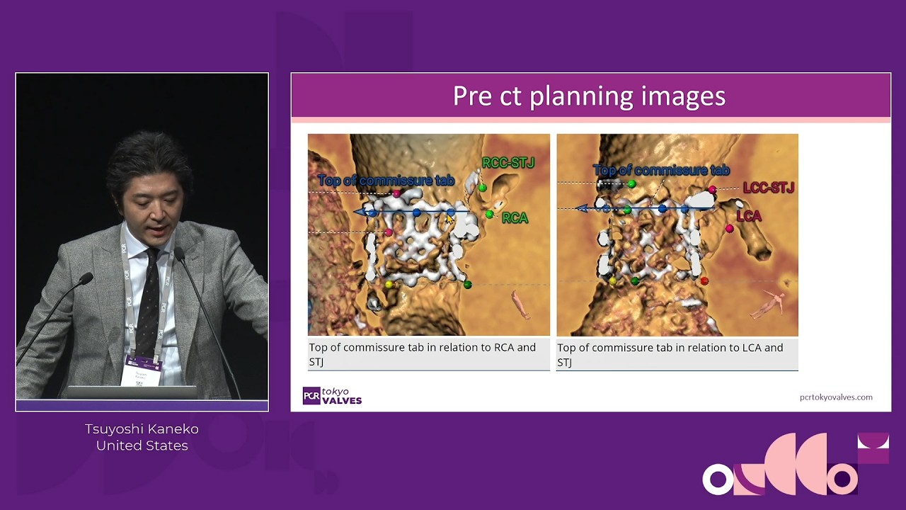 Learn from the experts: lifetime management for Evolut first redo TAVI (TAV-in-TAV) and explant