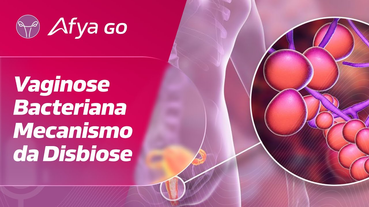 Qual o mecanismo da disbiose que leva &agrave; vaginose bacteriana?