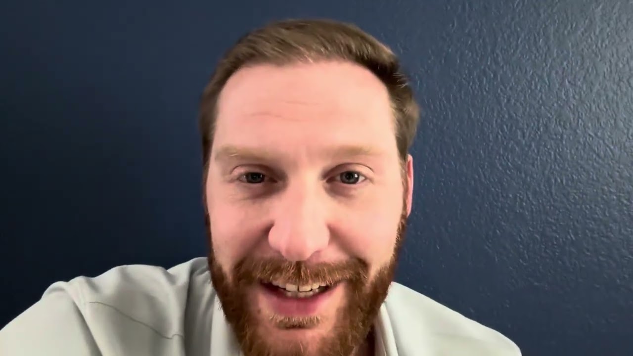 Month 4 Post Hair Transplant on my journey to Cosmedica Turkey.