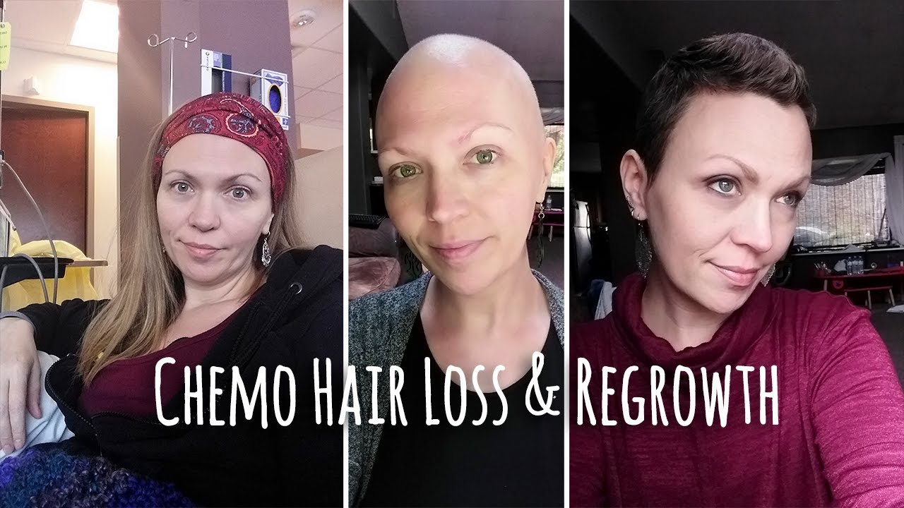 Chemo Hair Loss and Regrowth Timeline