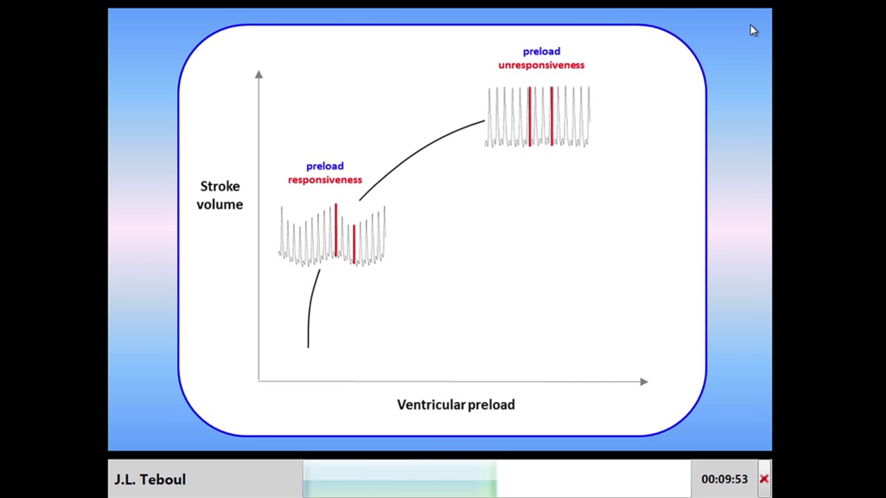 J.L. Teboul - Predicting fluid responsiveness