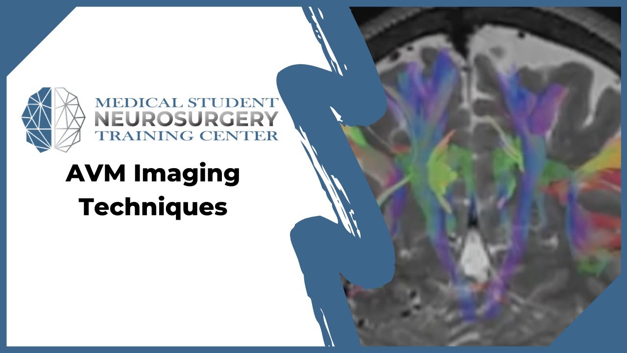 AVM Imaging Techniques