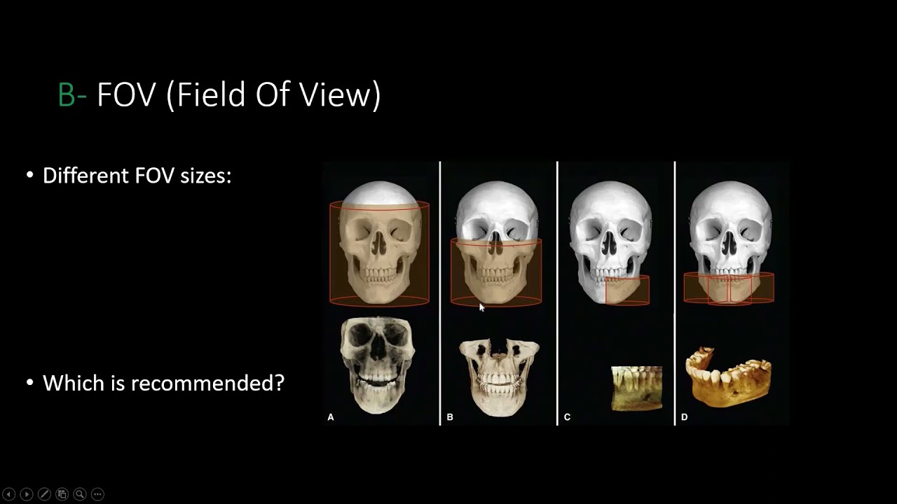 9- CBCT requirements for Guided Surgery