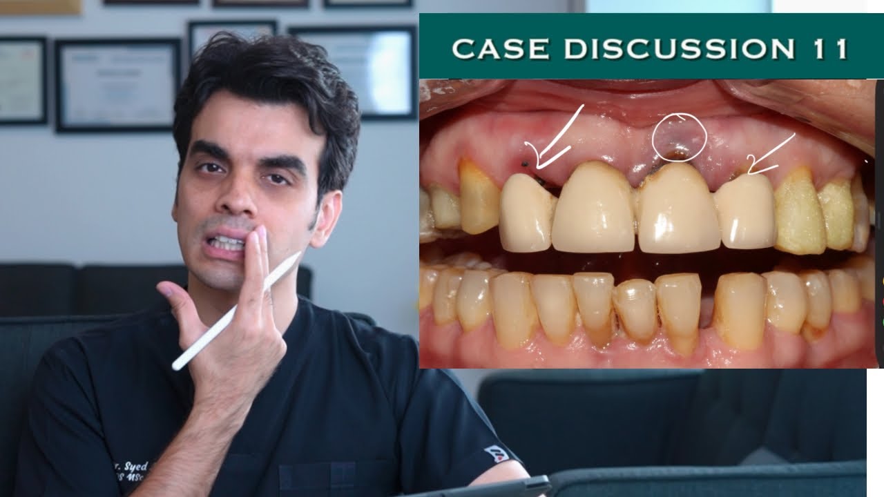 Case Discussion 11 - Replacing an Old Bridge