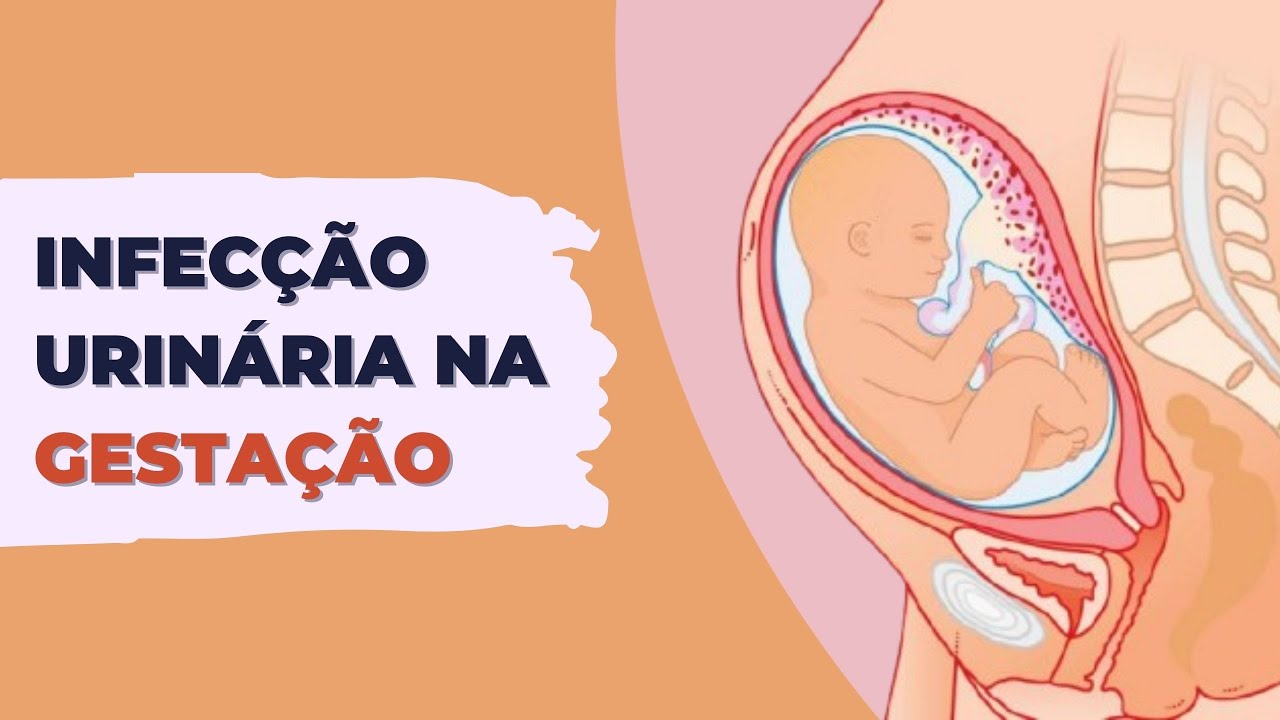 ESTOU COM INFECÇÃO URINÁRIA NA GRAVIDEZ! E AGORA?