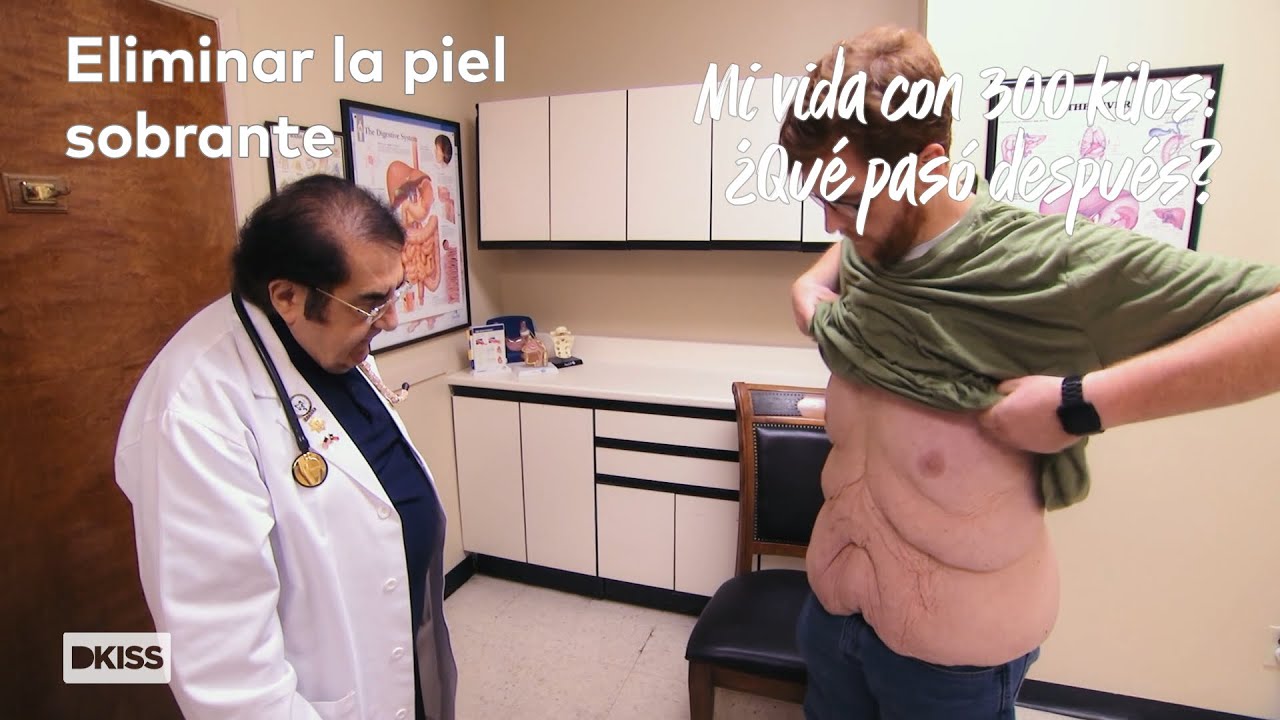 Operación para eliminar el exceso de piel | Mi vida con 300 kilos: ¿Qué pasó después?