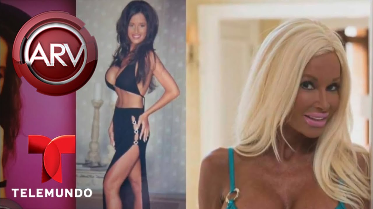 Madre de tres hijos dispuesta a ser Barbie | Al Rojo Vivo | Telemundo