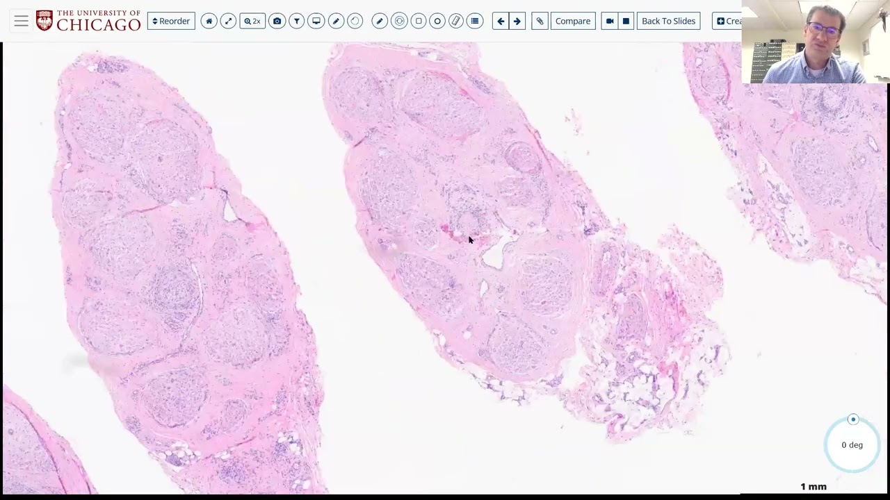 AANP Teaching Rounds - October 22, 2025 - Peripheral Nerve Biopsies