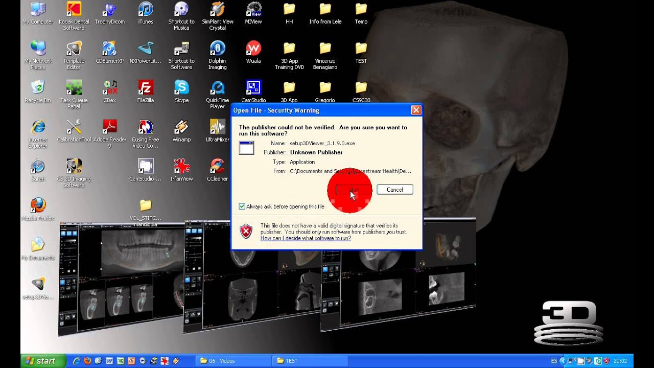 Tutorial CS 3D imaging software. Carestream. 01 Descarga e instalacion del software.avi