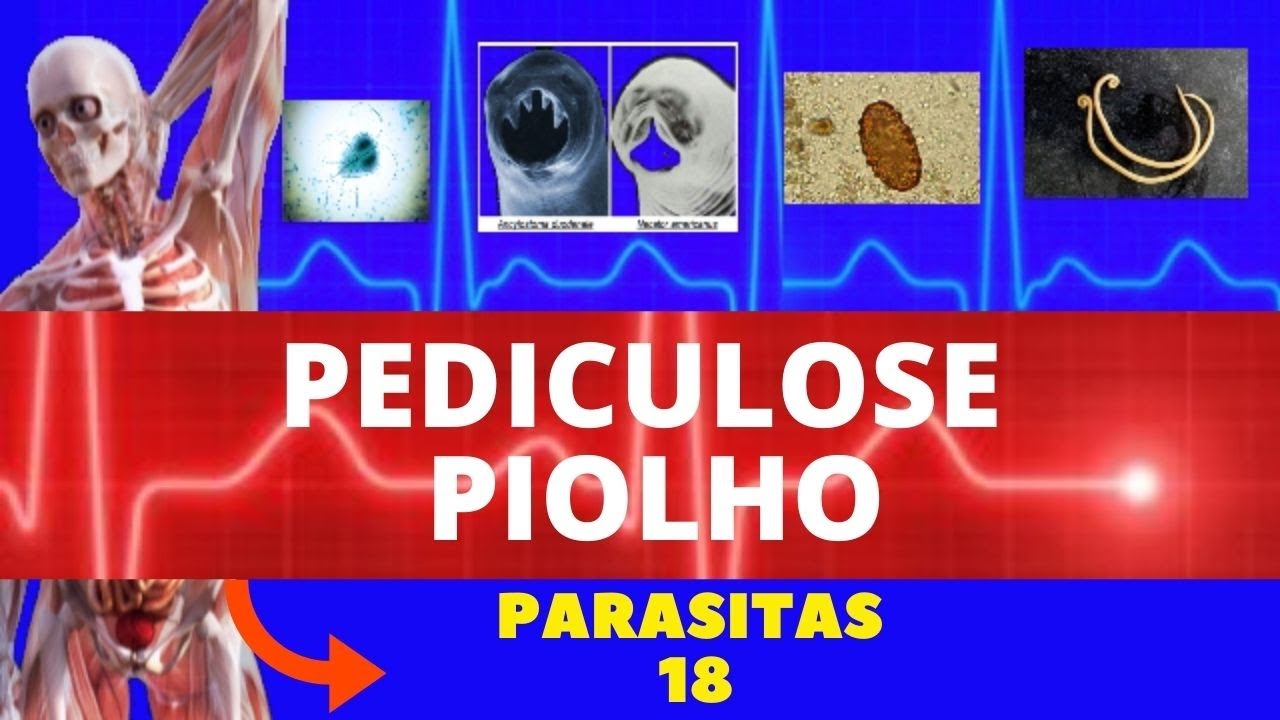 PEDICULOSE (PIOLHO) - PEDICULUS HUMANUS E PTHIRUS PUBIS - PARASITOLOGIA| INFECTOLOGIA