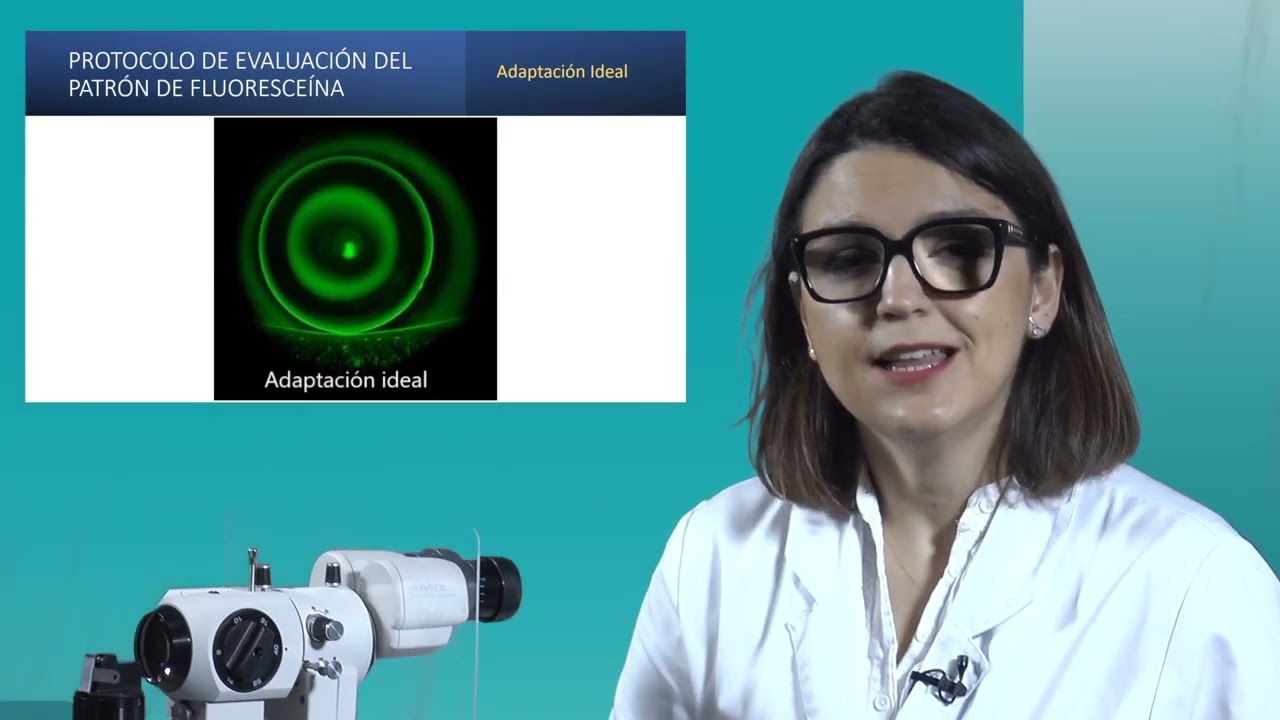 2 Ortoqueratología con lentes RPG (Orto-K)
