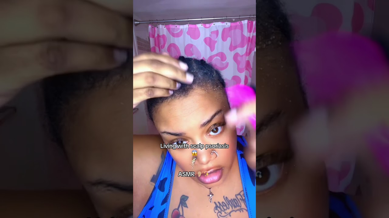 Scratch Session 😩😩 #asmr #fypシ #youtube #viral #haircare #scalp 