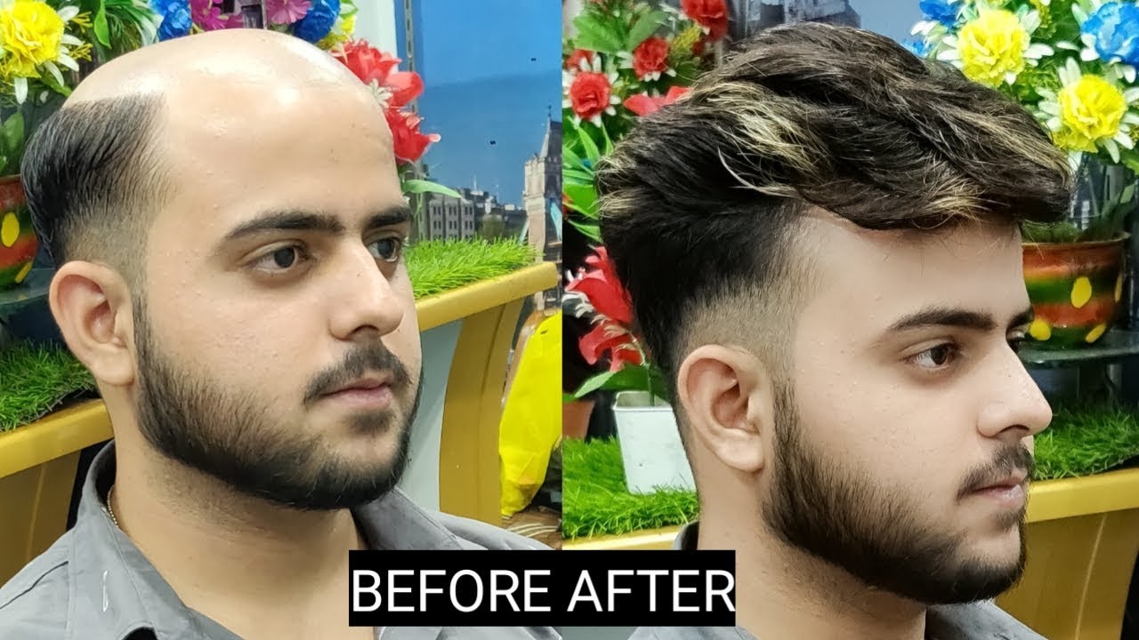Stylish hair patch system call us 📲 9650914665 and whatsap also, by anas sheikh