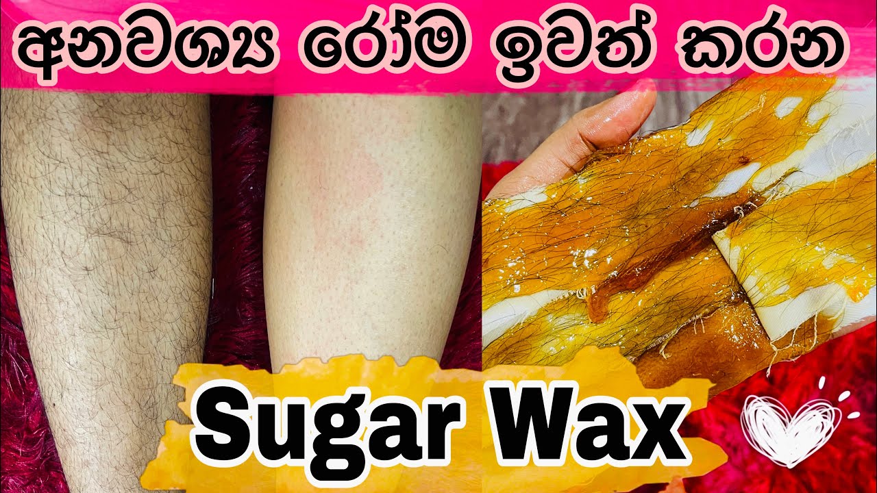 අනවශ්‍ය රෝම ඉවත් කරන Sugaring Wax for Body and Facial Hair | DIY Sugaring Wax Recipe | SLviki Media