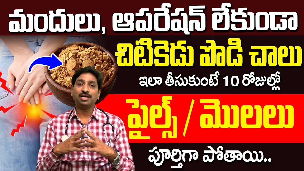 Dr Srinivas - పైల్స్/మొలలు పూర్తిగా పోతాయి.! | How To Get Relief From Piles In 10 Days | iDream
