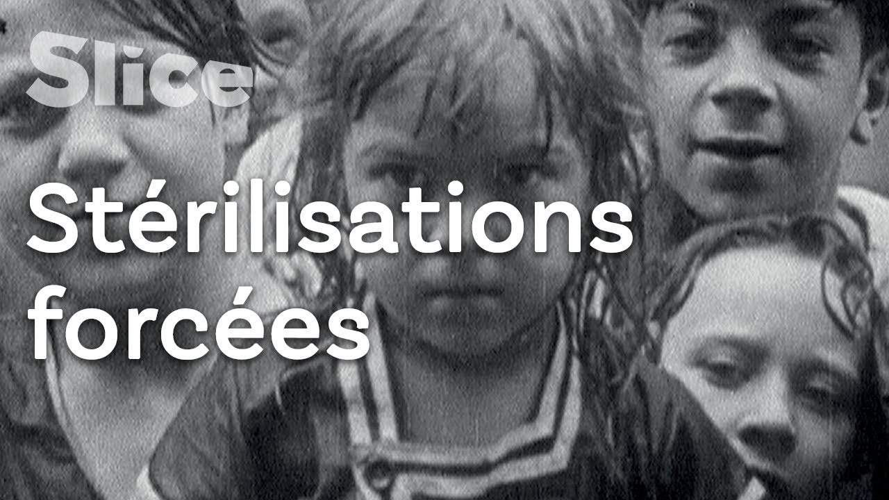 L’eugénisme dans les États-Unis du 20ème siècle | SLICE