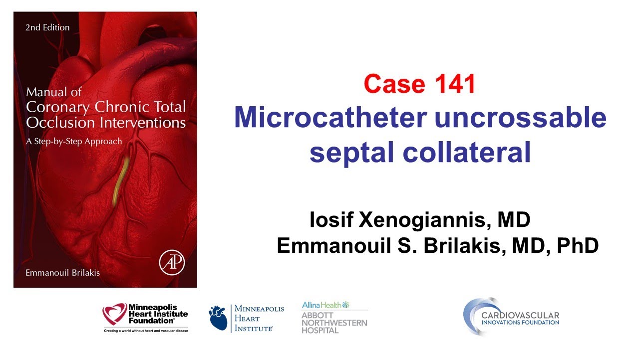 Case 141: Manual of CTO PCI - Microcatheter uncrossable septal collateral