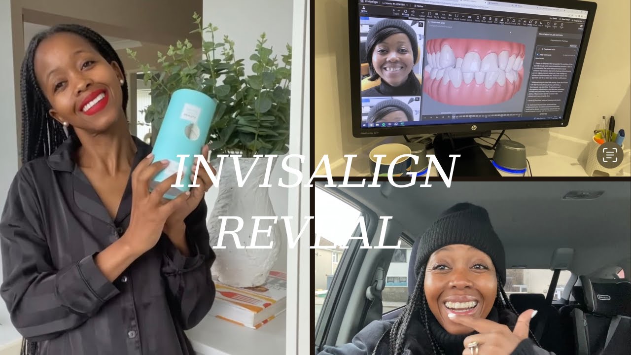MY INVISALIGN JOURNEY| THE FINAL REVEAL
