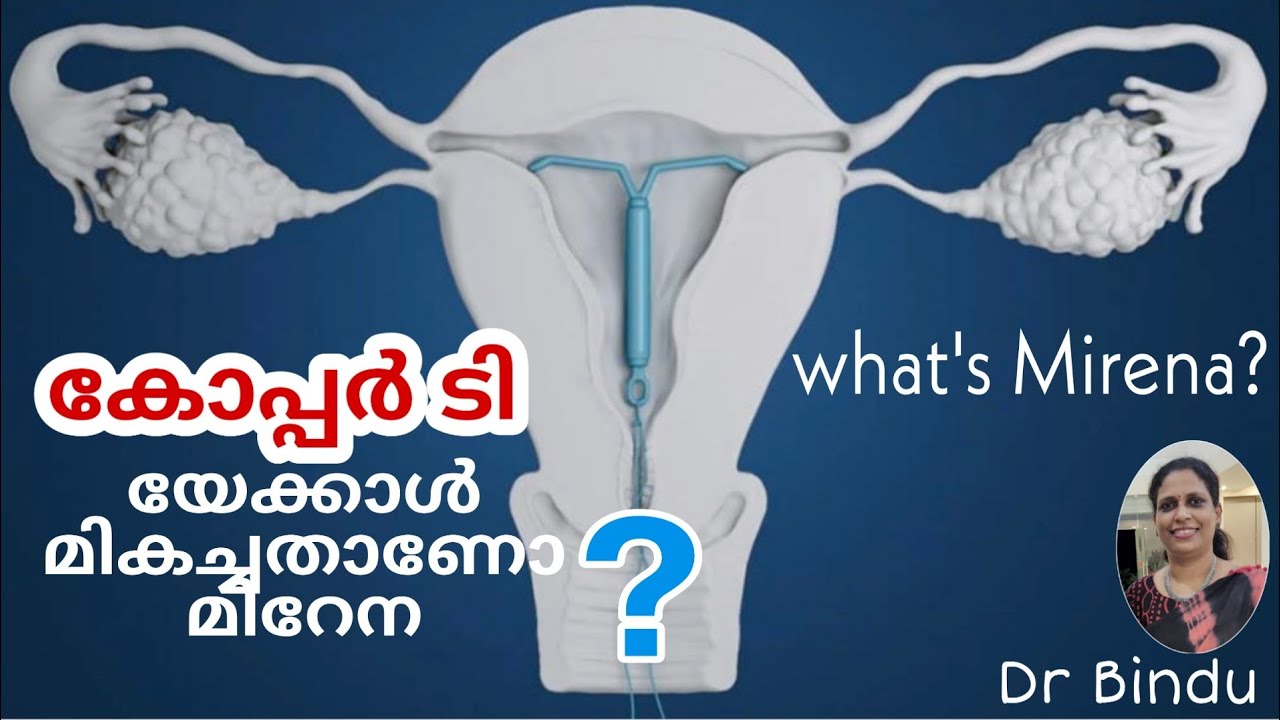 കോപ്പർ ടി യേക്കാൾ മികച്ച മിറേന/ഗർഭനിരോധനം/Mirena contraceptive/Dr Bindu mom health series
