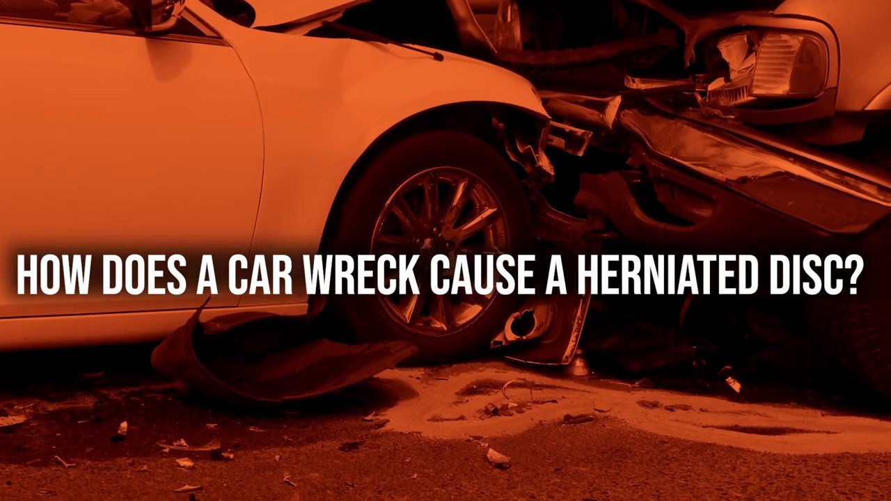 Zarzaur Law, P.A. TV: How Does a Car Wreck Cause a Herniated Disc?
