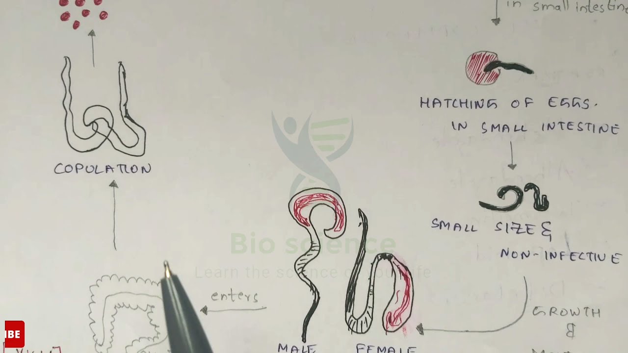 Trichuriasis | Whipworm structure, Life cycle, Symptoms and treatment | Bio science