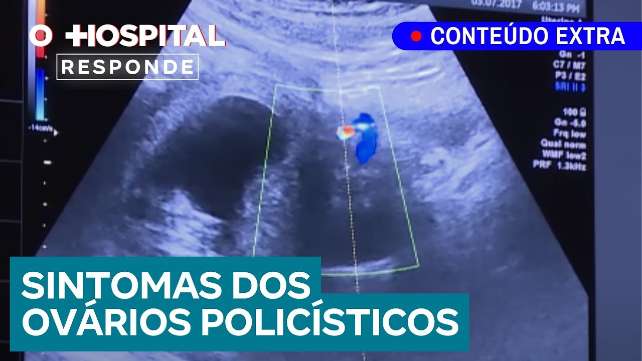 Ovários Policísticos: confira os sintomas que você não deve ignorar | O Hospital Responde