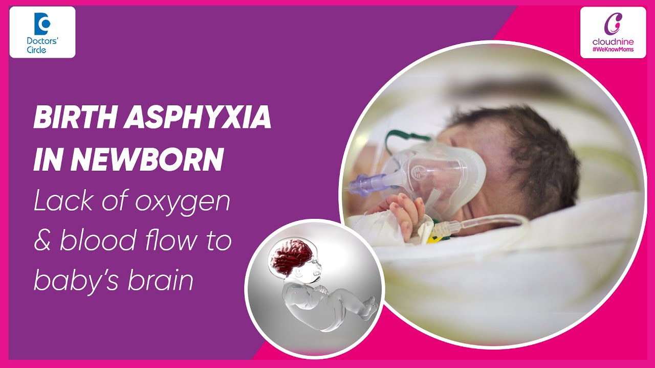 Birth Asphyxia | Low Oxygen to Baby's Brain | Birth #asphyxia in #newborn babies - Dr. Nitin Gupta
