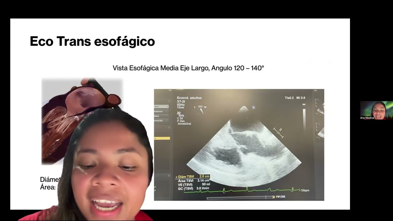 Calculo GC por eco