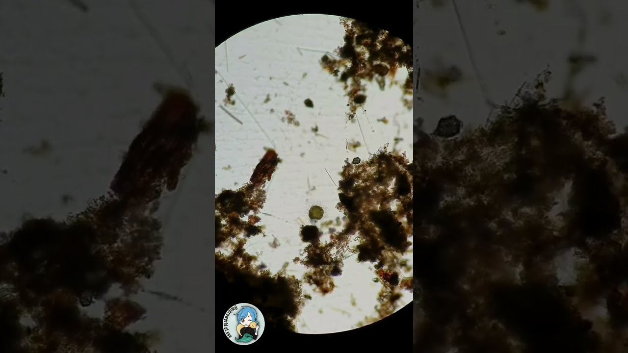 Corona virus in microscope 😧😧😧/Covid19/#SHORTS