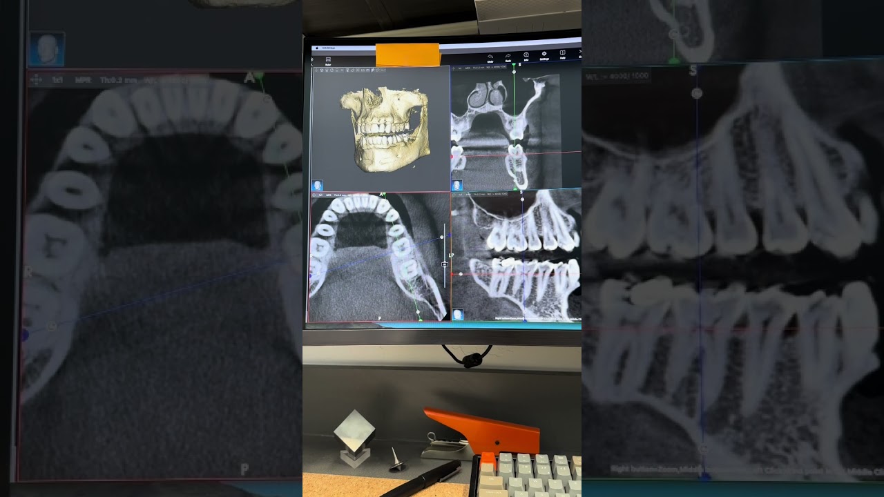 Taking a CBCT #cbct #digitaldentisty #dentist #dentalimaging #conebeam #science #dentalartistry