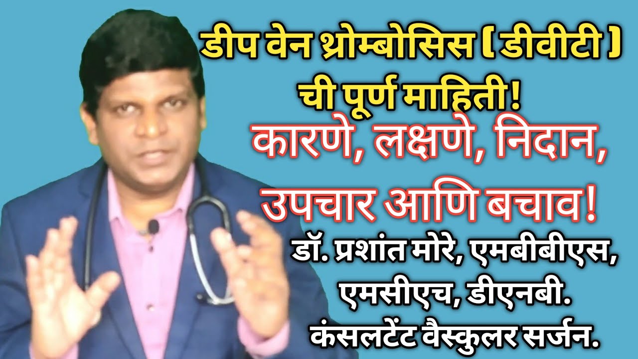 DVT Treatment in Marathi | Deep Venous Thrombosis Treatment | dvt treatment