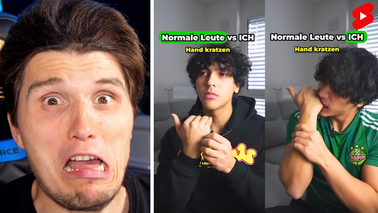 Paluten guckt Shorts 358.0