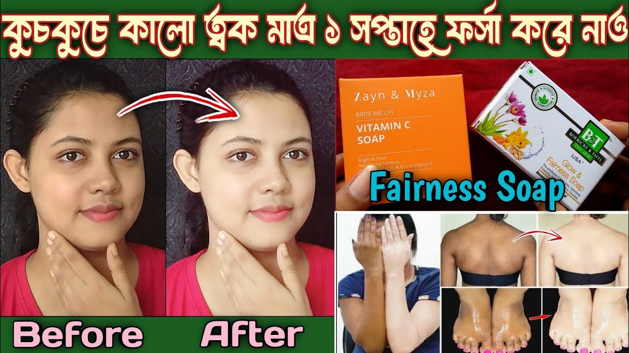 B&T Glow & Fairness Soap Vs Zayn & Myza Vitamin C Soap for Skin Whitening || কোনটা Best?