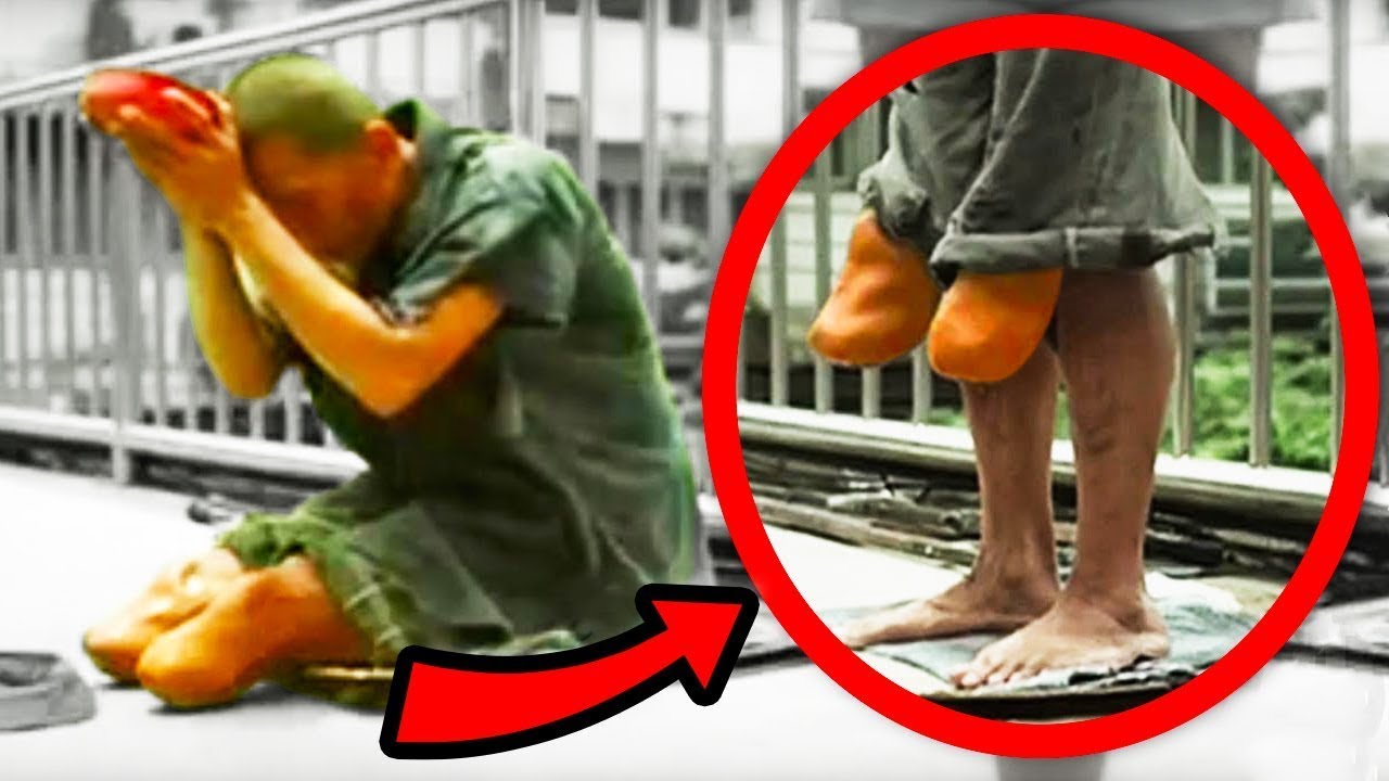EXTREME Lengths Beggars Go To
