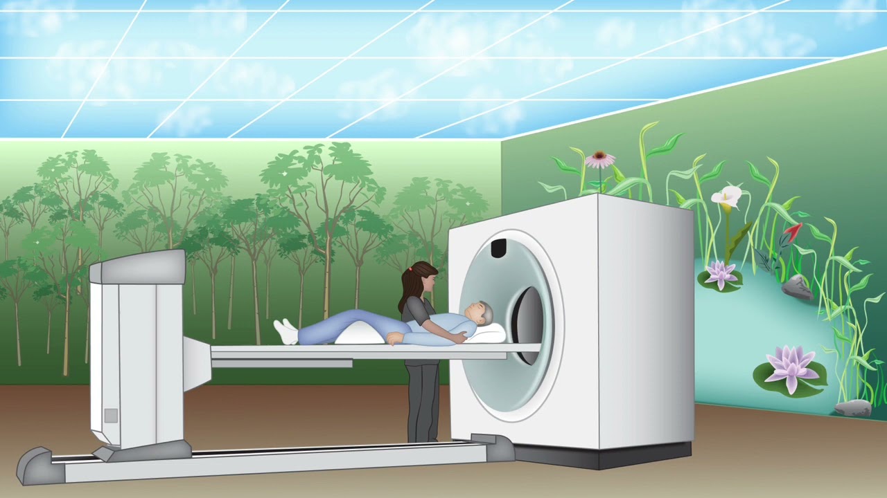 LGI Bleeding 4a   Angio