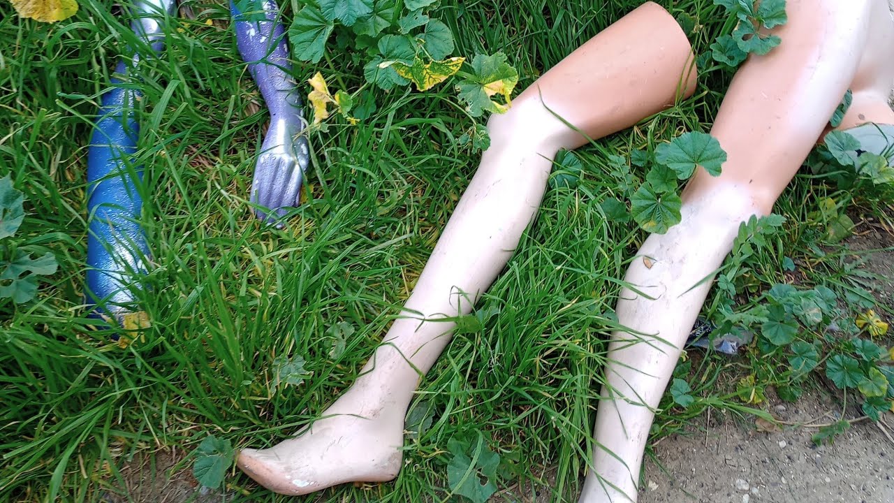 Let's talk about my prosthetic leg!