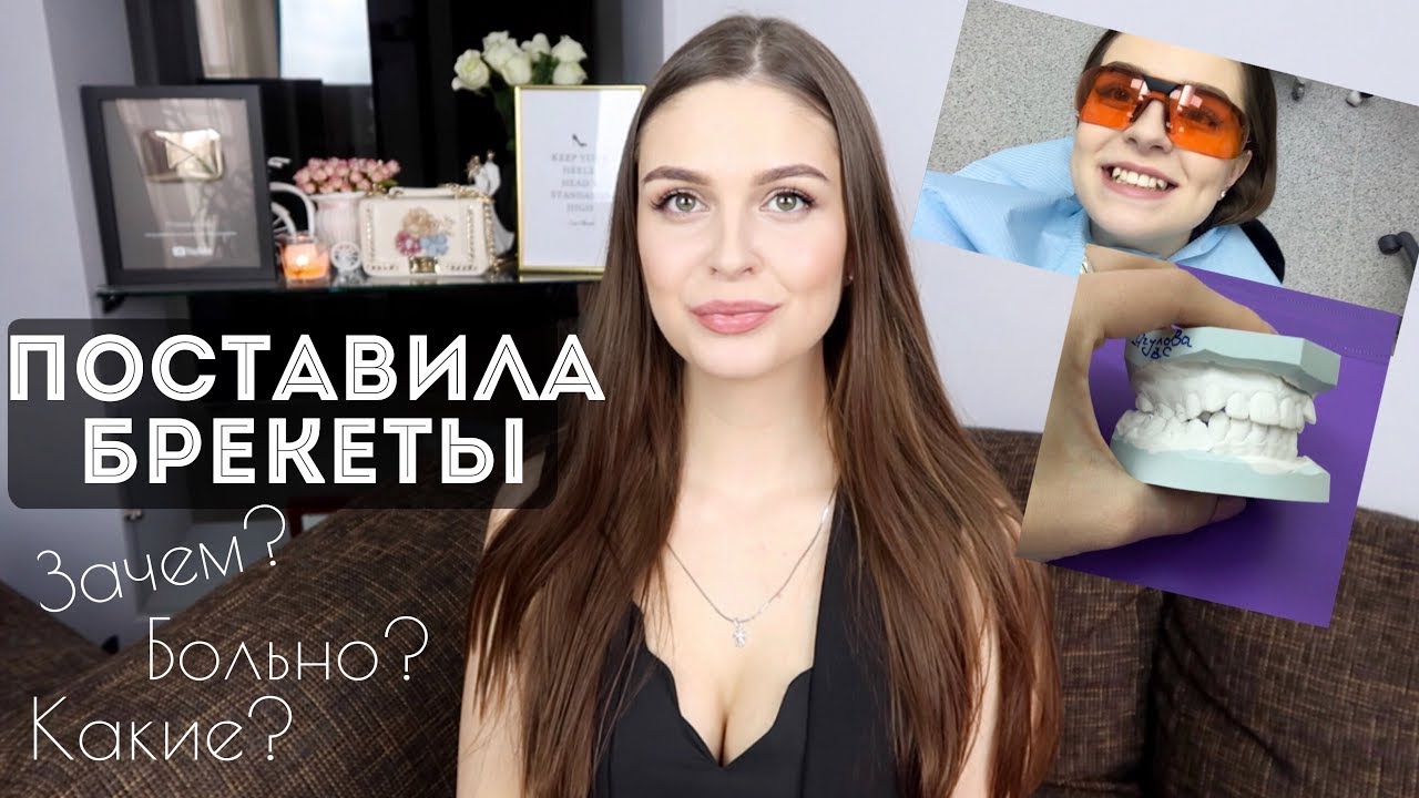 Я СТАВЛЮ БРЕКЕТЫ! БОЛЬНО? Мои первые впечатления 😬