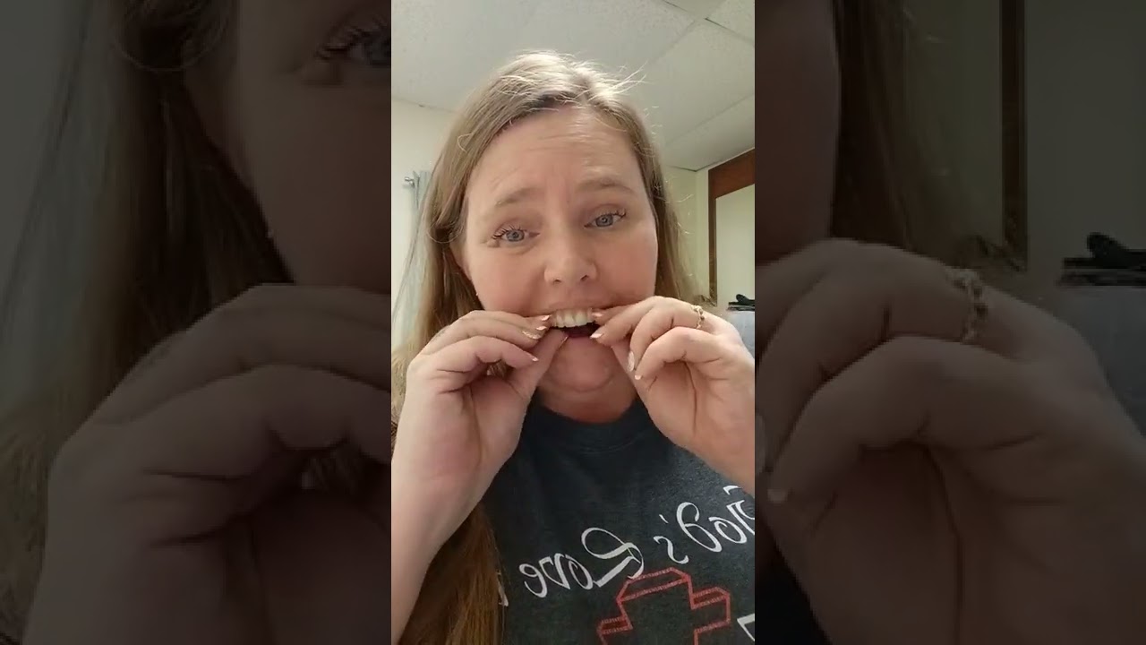Taking dentures out/Up close and personal!!🥴🤪