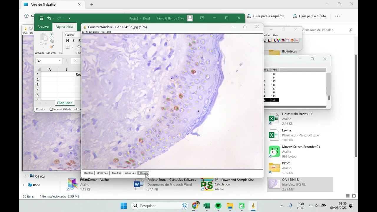 Tutorial ImageJ - Contagem de células