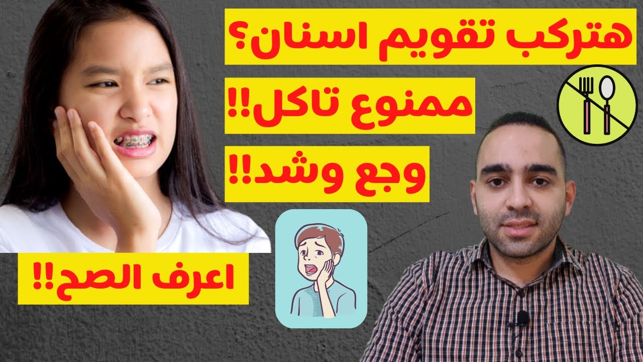 تعليمات بعد تركيب تقويم الاسنان | الاكل | غسيل الاسنان | الالم