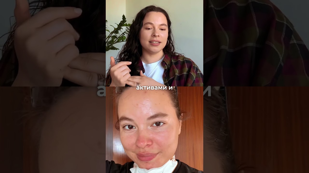 👆🏼смотрите полное видео про акне и ошибки дерматологов