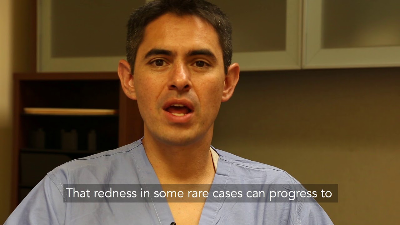 Radiation Therapy | What Are the Side Effects? | The Patient Story