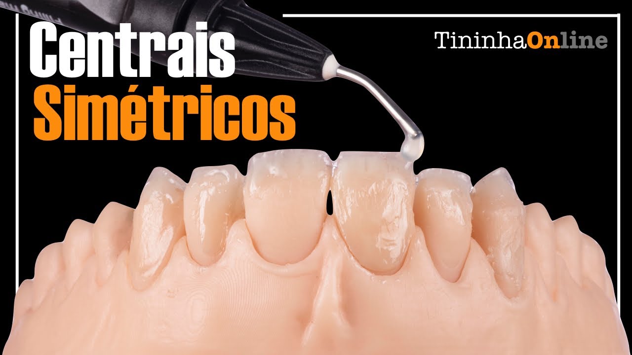 LIVE 1: Como deixar seus centrais simétricos!