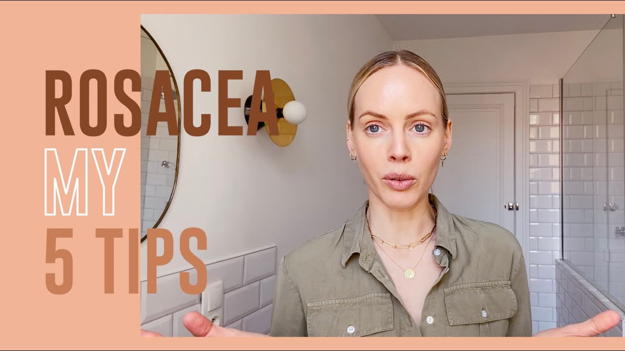 Mes 5 conseils pour mieux vivre sa rosacée | MATHILDE LACOMBE