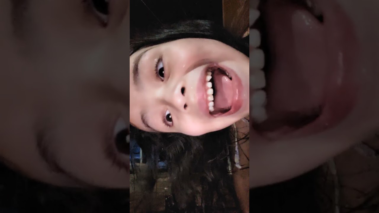 Última parte