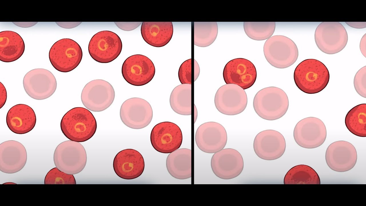 Células falciformes: selección natural en humanos | Video HHMI BioInteractive