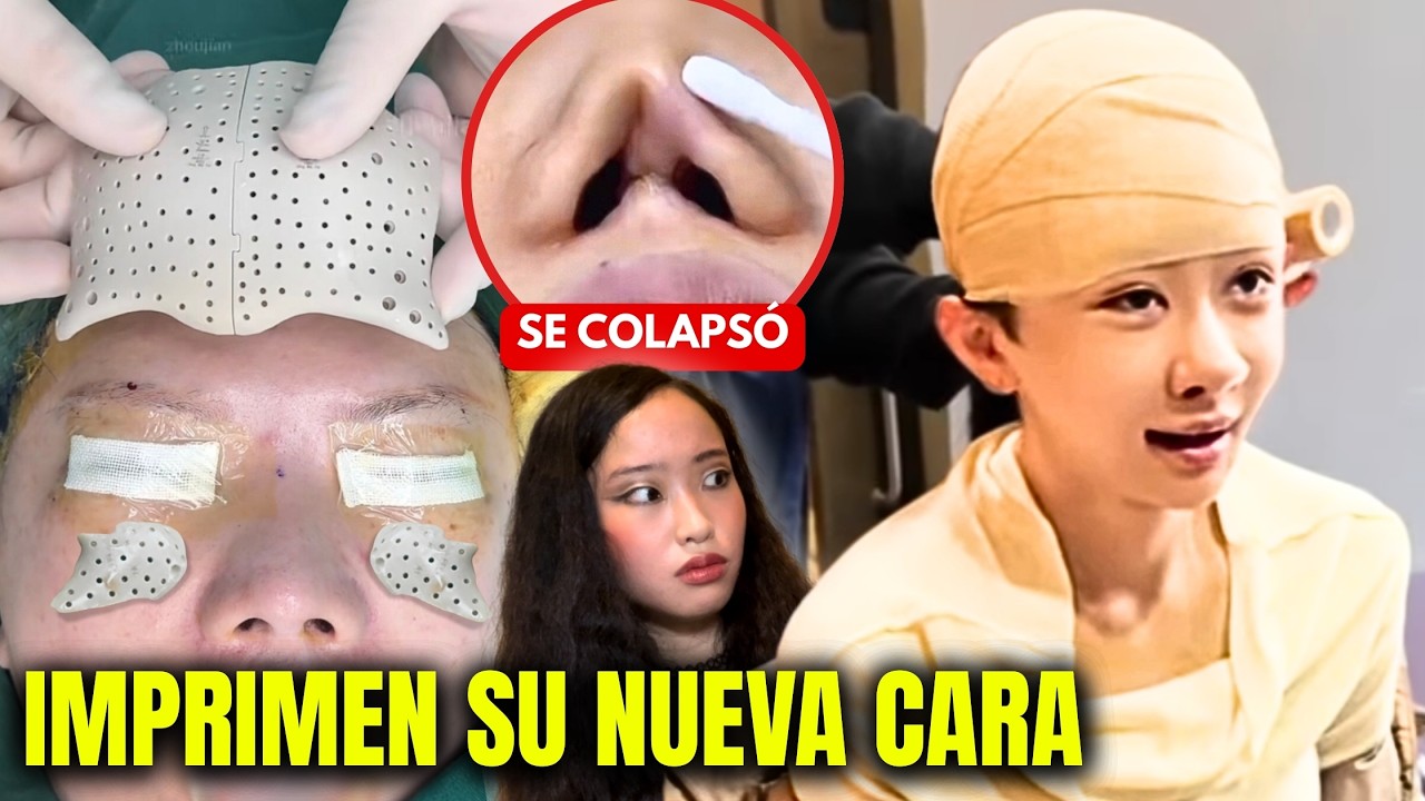 Se implantan PLÁSTICO INDUSTRIAL EN LA CABEZA...¡con una IMPRESORA 3D!