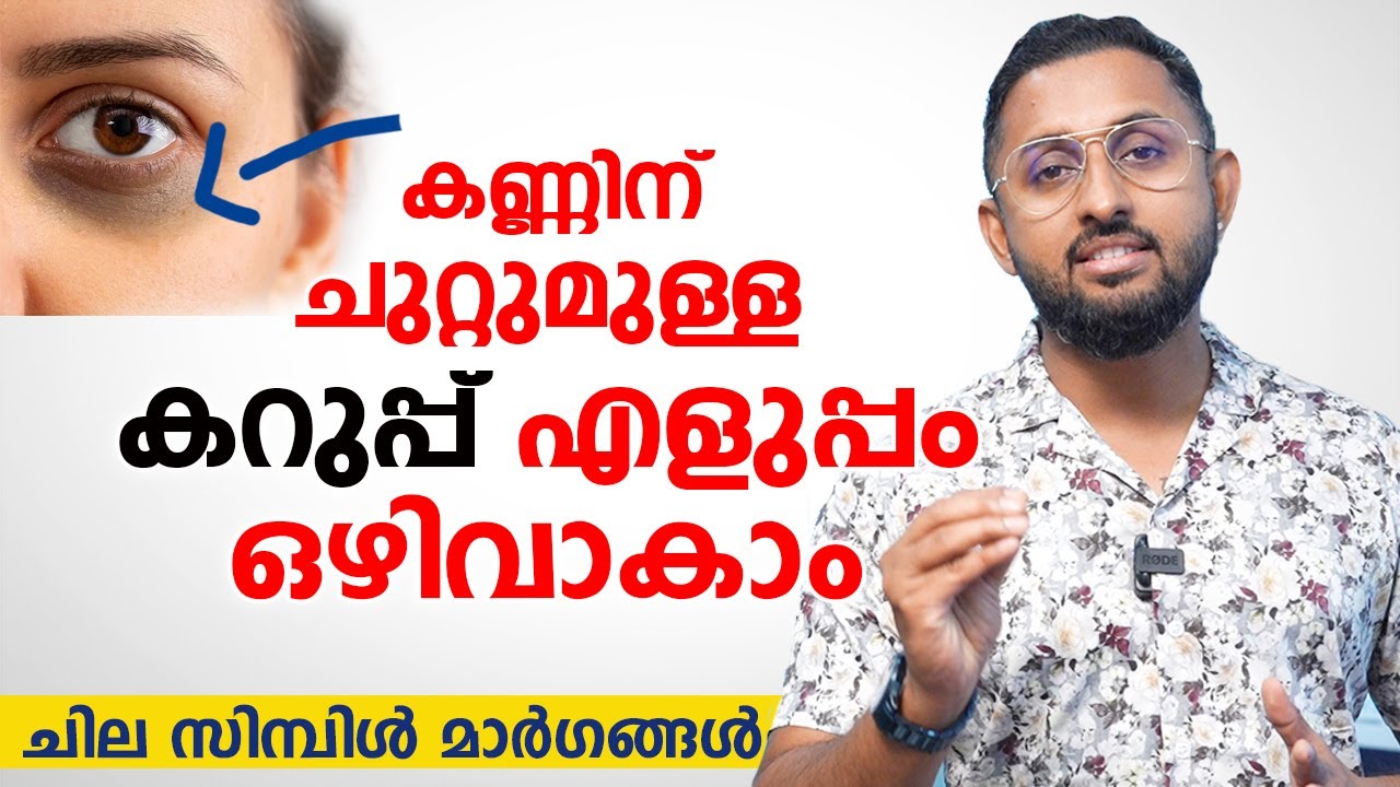 കണ്ണിന് ചുറ്റുമുള്ള കറുപ്പ് എളുപ്പം മാറ്റാം | under eye dark circles | Dr varun Nambiar