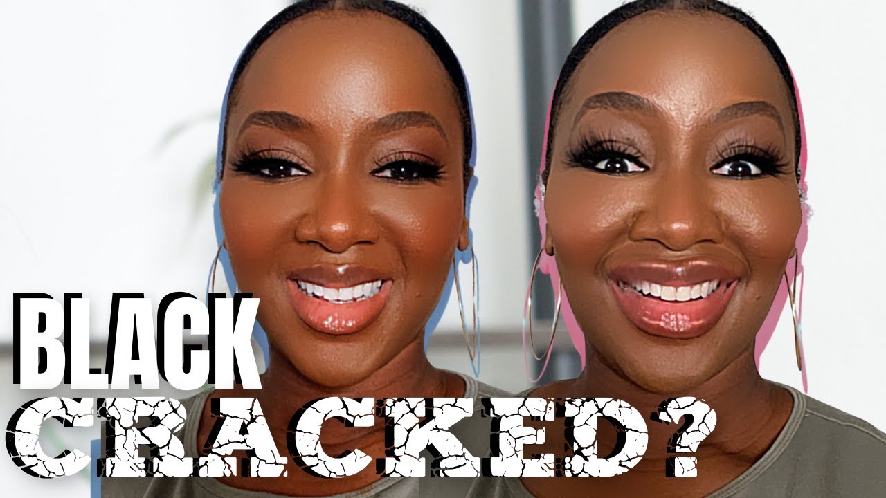 4 Skincare Procedures to Consider (Black Skincare Over 40)