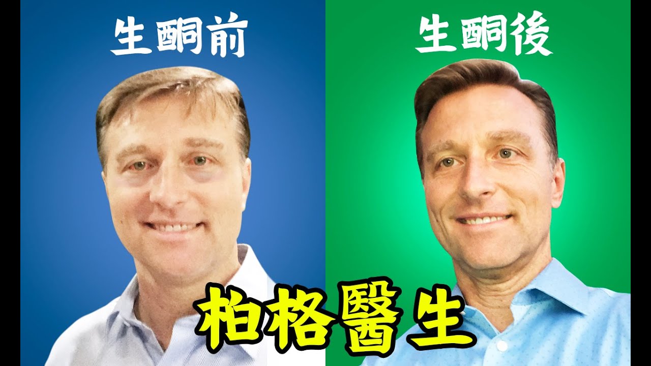 臉告訴你血糖7件事,瘦臉,減雙下巴,自然療法,柏格醫生 Dr Berg